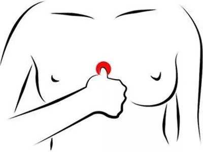 乳腺结节刮前臂和膻中