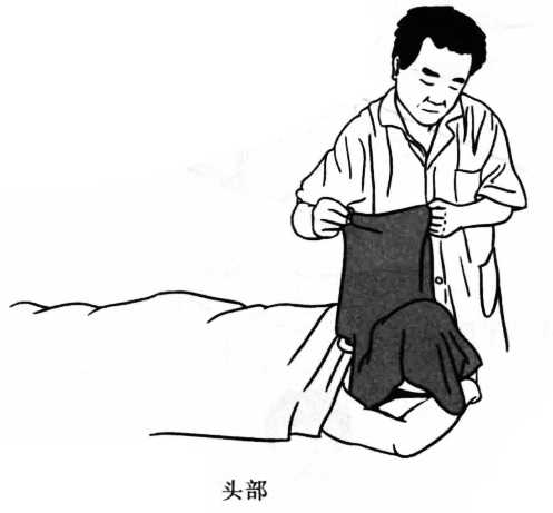 火疗常见的施术部位