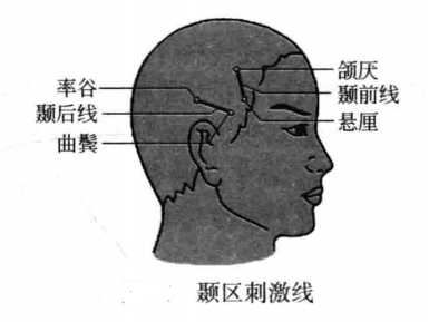 飞针技术颞区刺激线