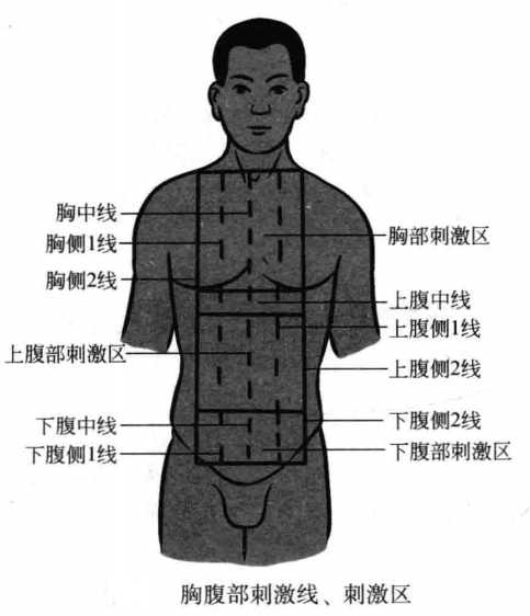 飞针技术上腹部刺激线