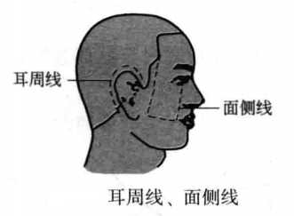 飞针技术面部刺激线